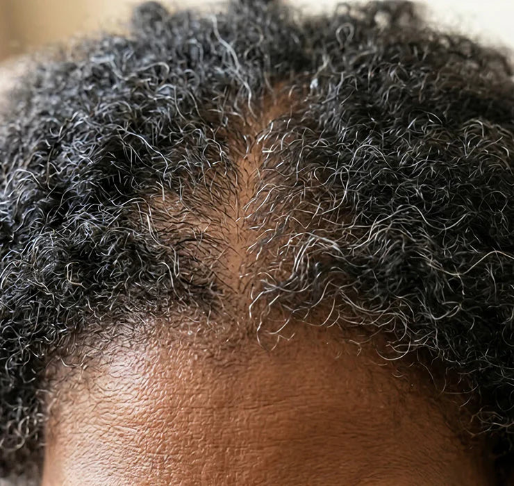 If Your Hair Keeps Falling Out, <br>Read This.