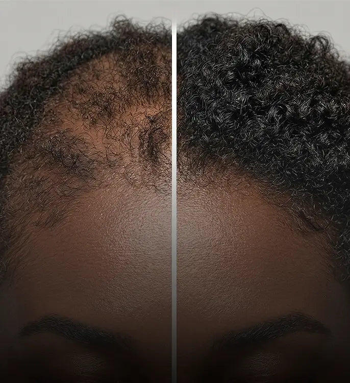 Hair growth before and after timeline